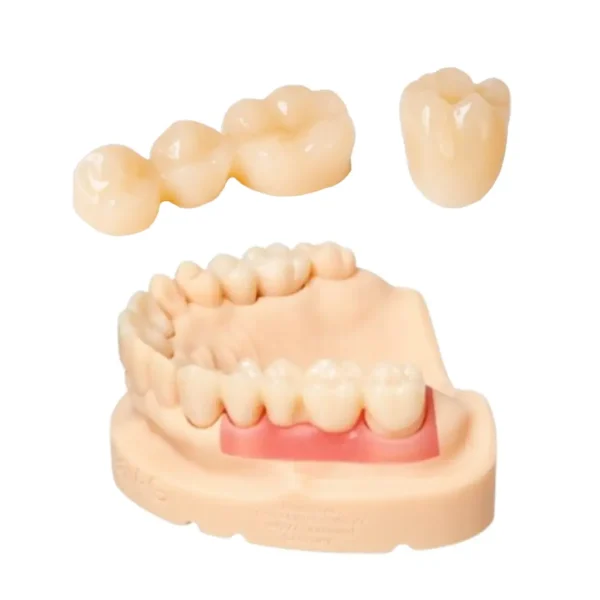 Resina Dentona Optiprint Lumina A2 500 grs. para coronas y puentes provisionales. - Imagen 4